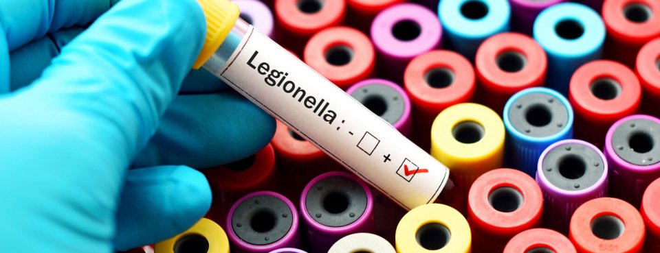 Legionella